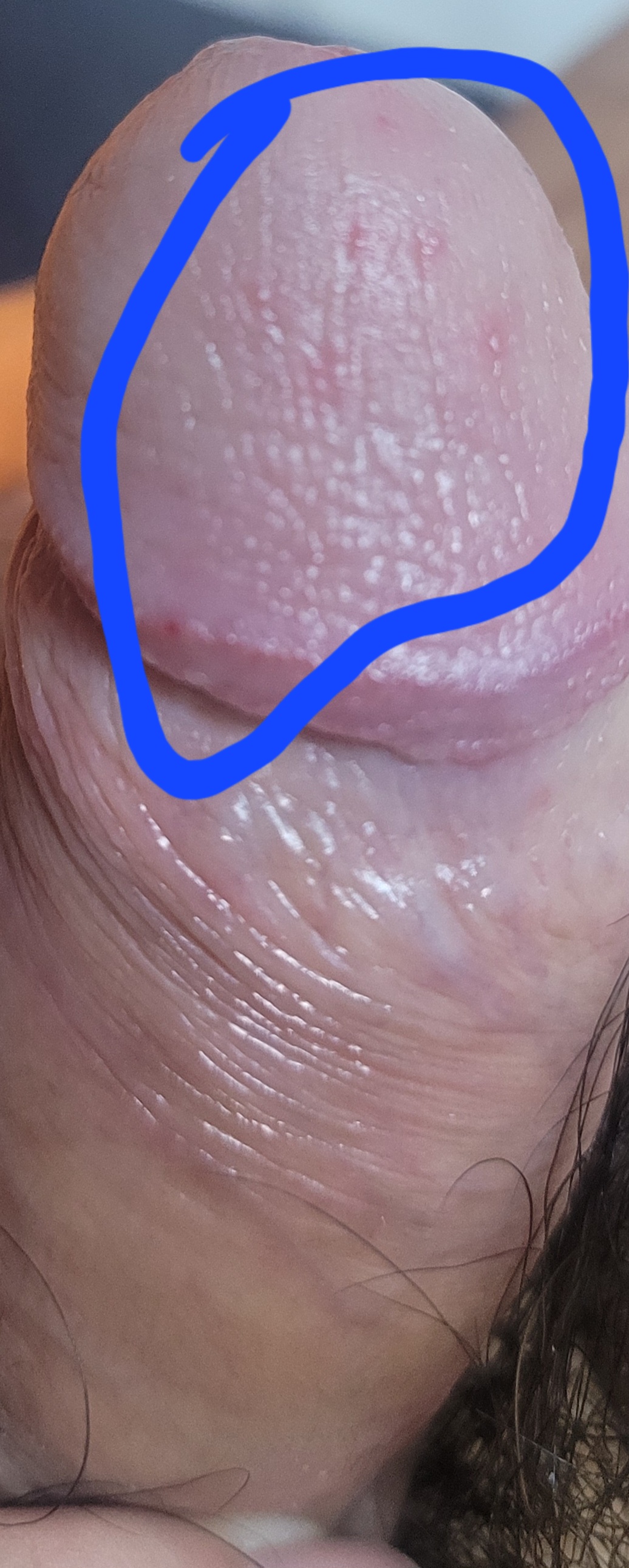 2번 째 사진