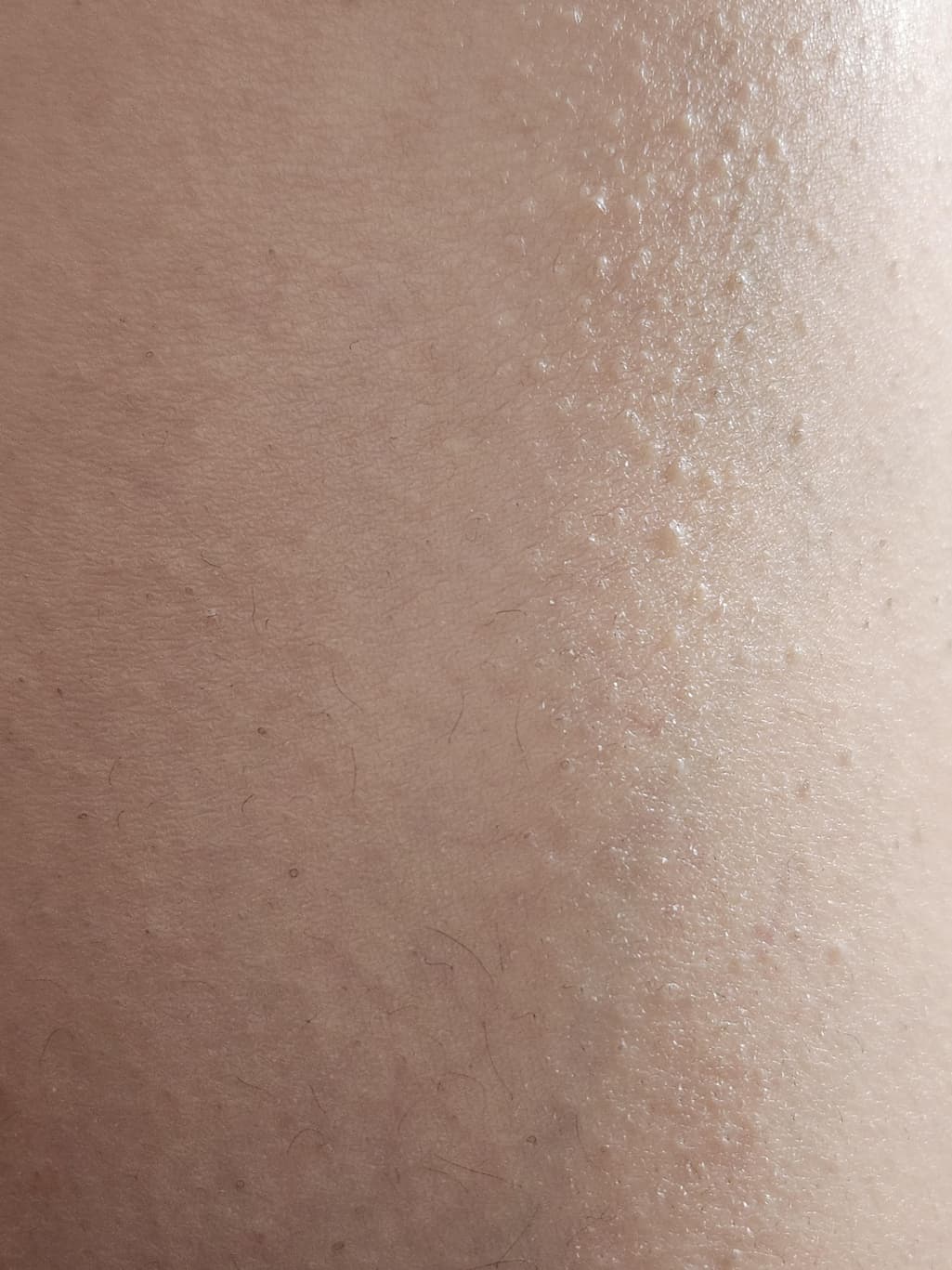 2번 째 사진