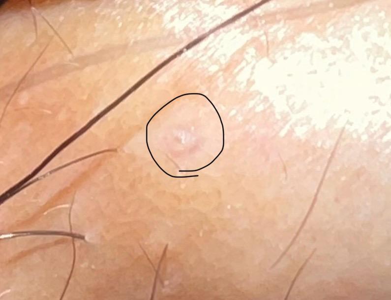 12번 째 사진
