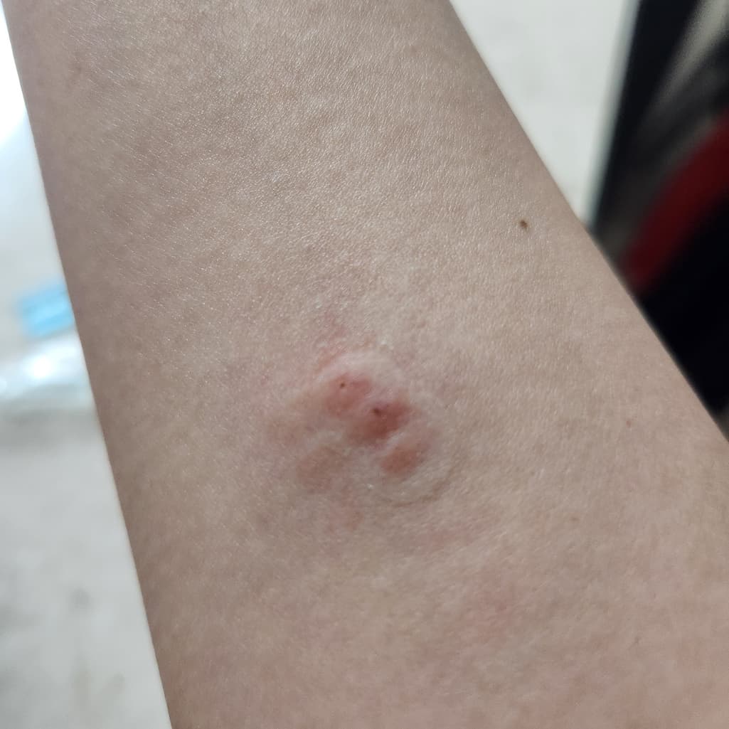 1번 째 사진