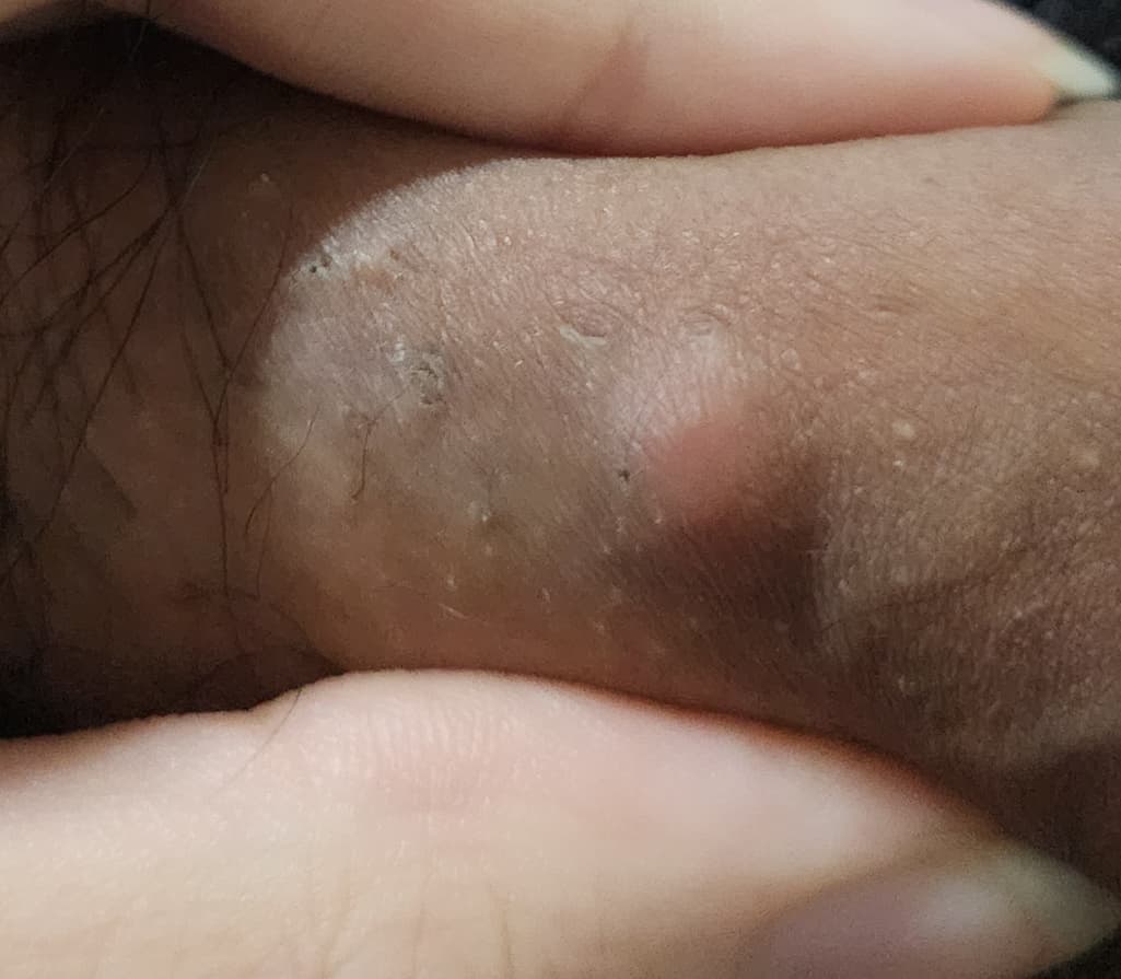3번 째 사진