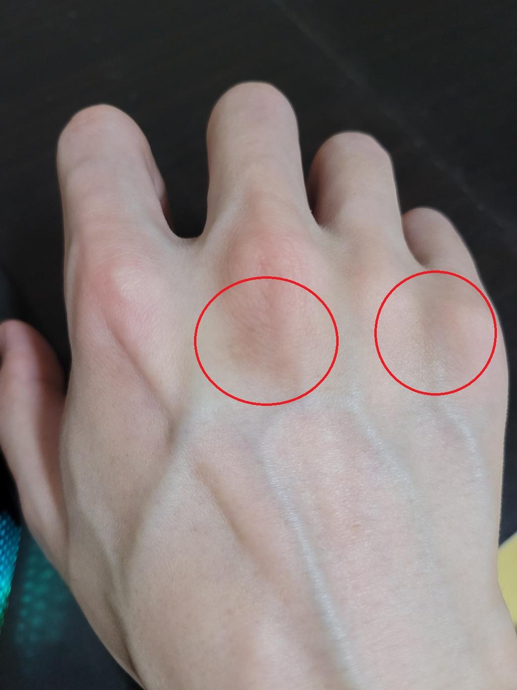 3번 째 사진