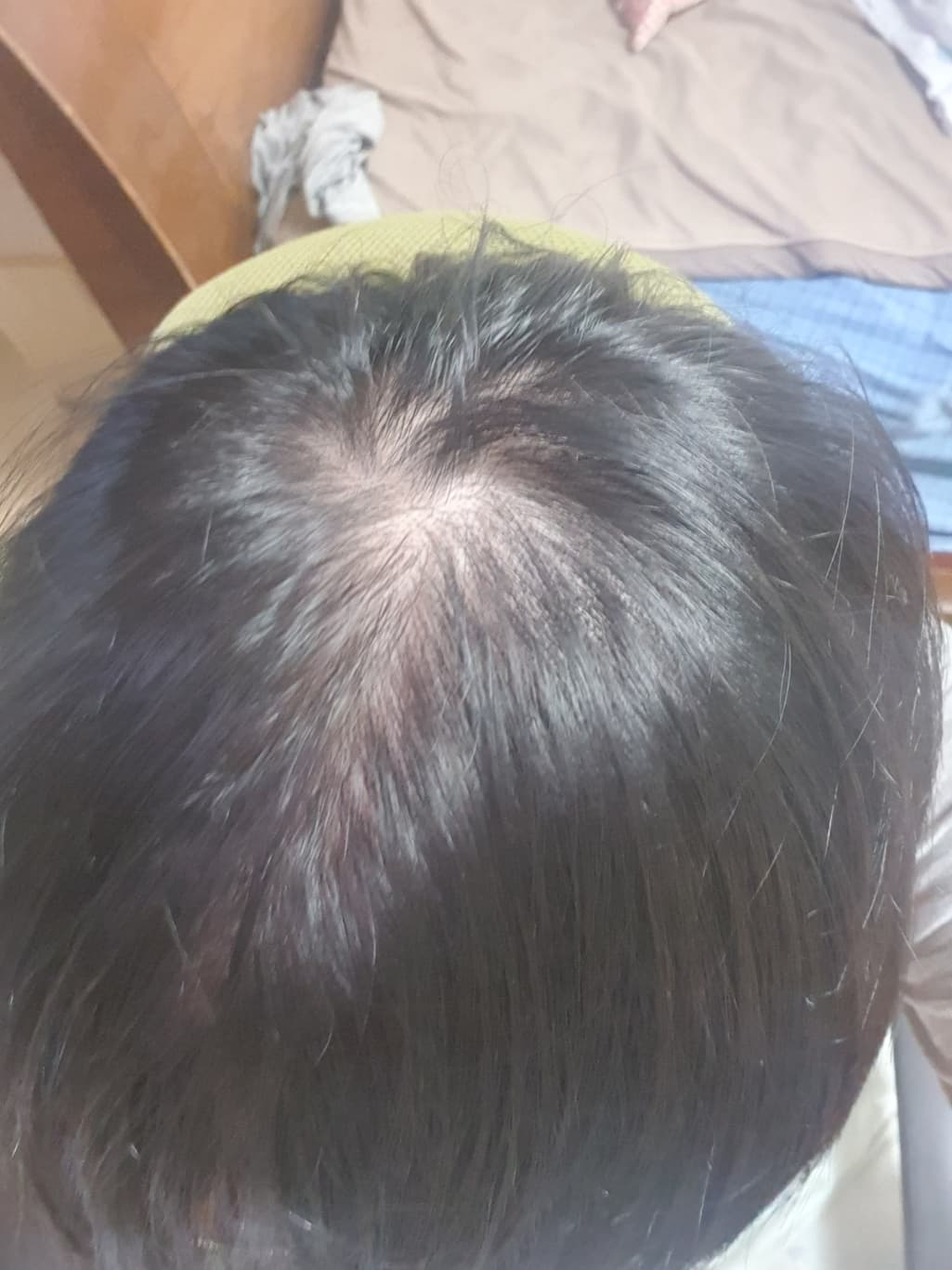 2번 째 사진