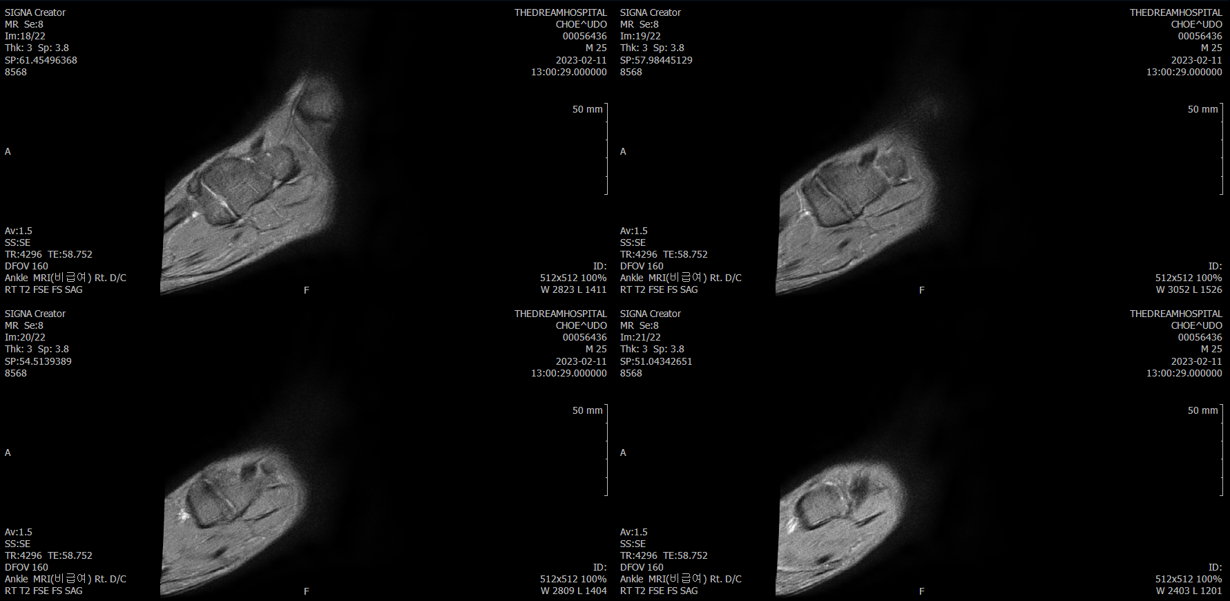 7번 째 사진