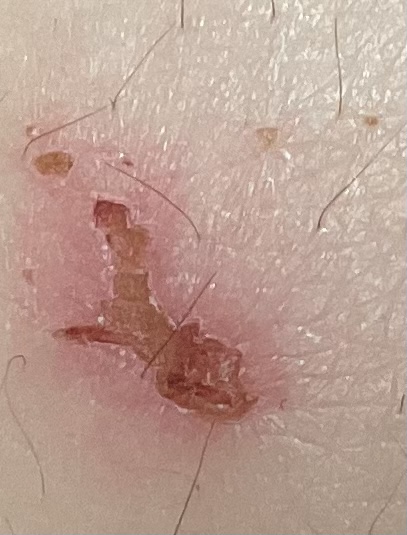 2번 째 사진