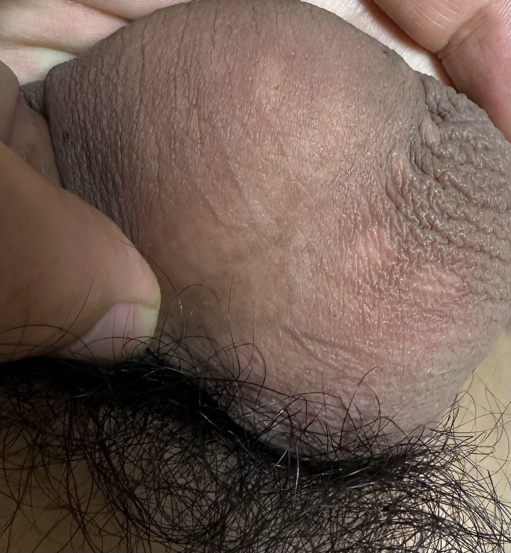 3번 째 사진