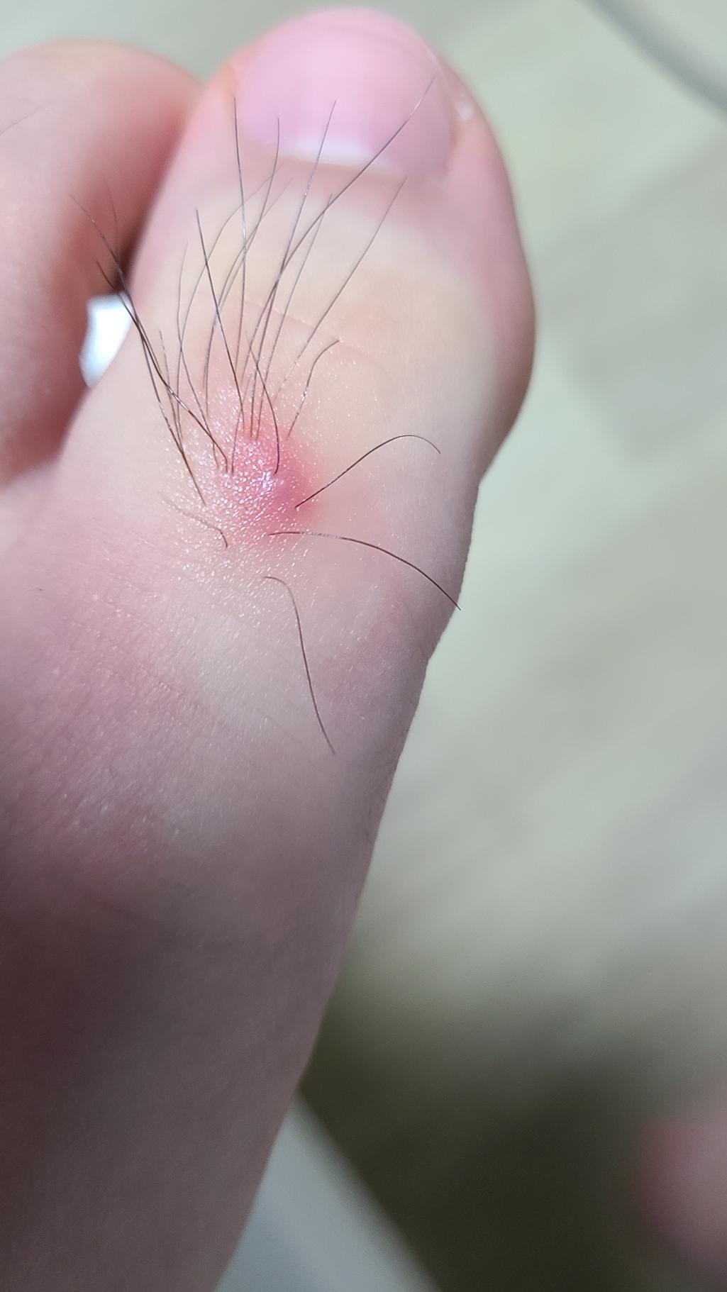 2번 째 사진