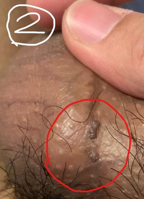 3번 째 사진