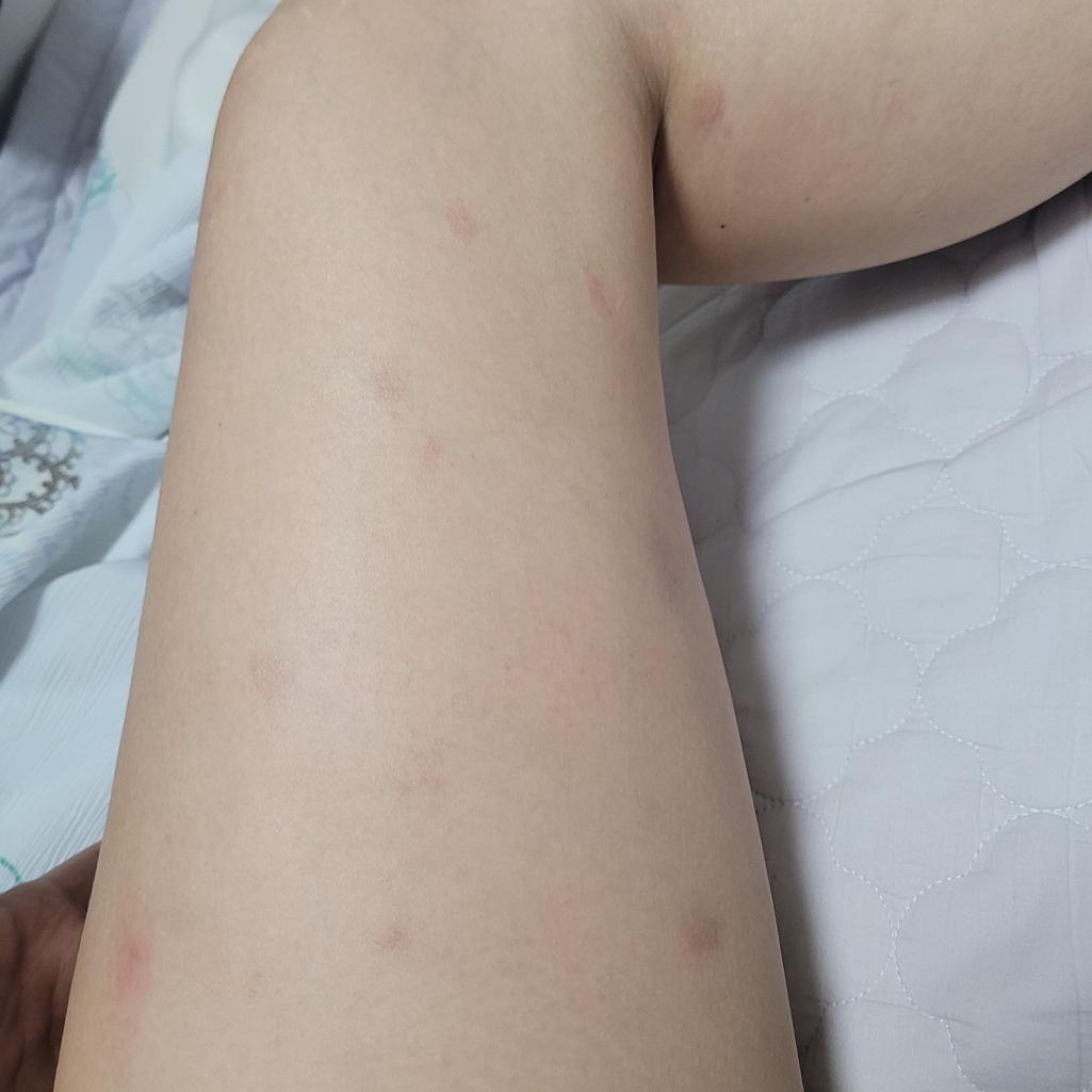 2번 째 사진