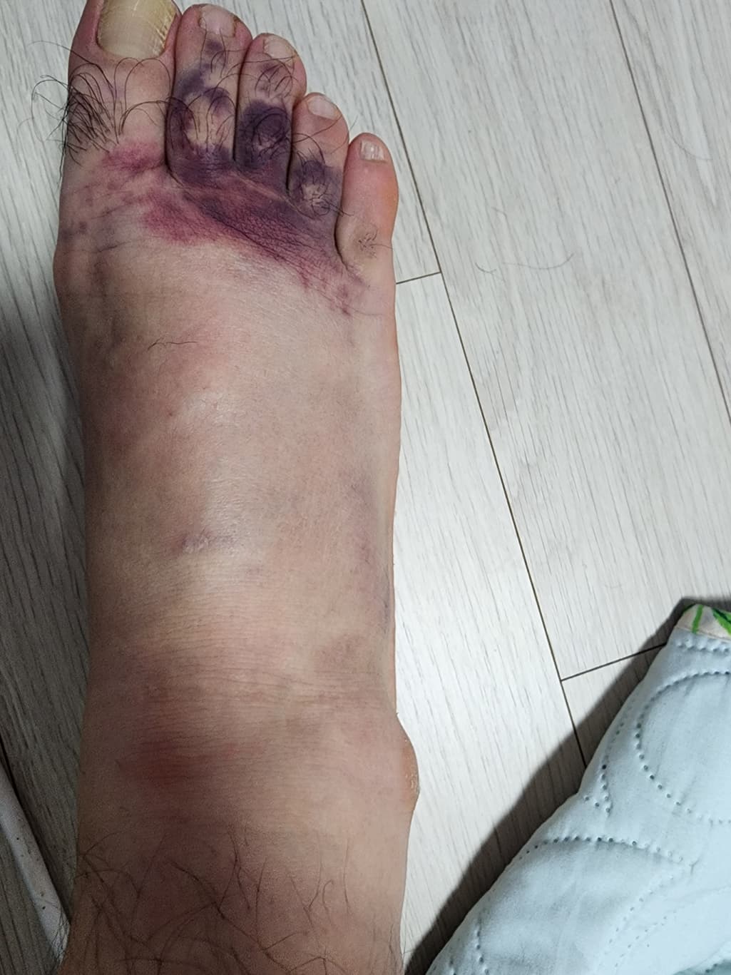 1번 째 사진