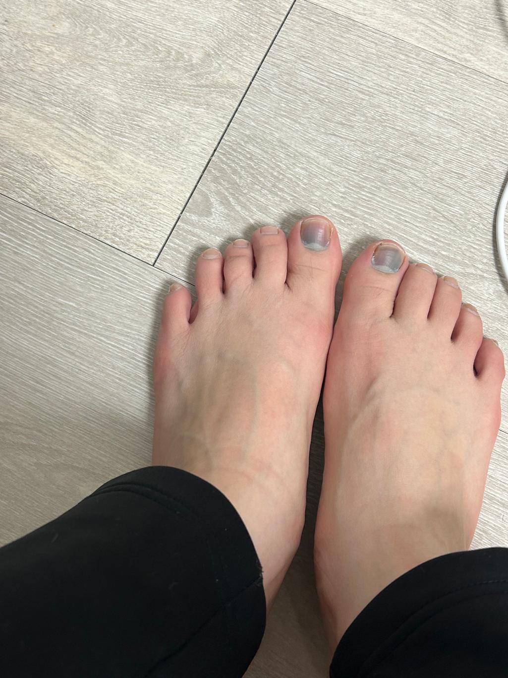 2번 째 사진