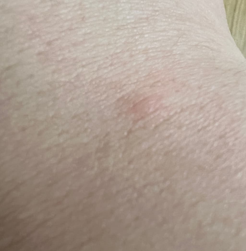 2번 째 사진