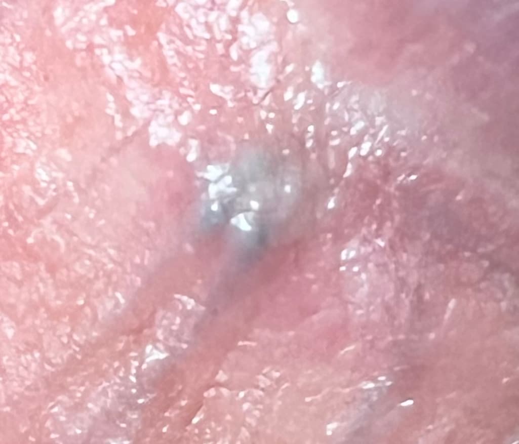 3번 째 사진