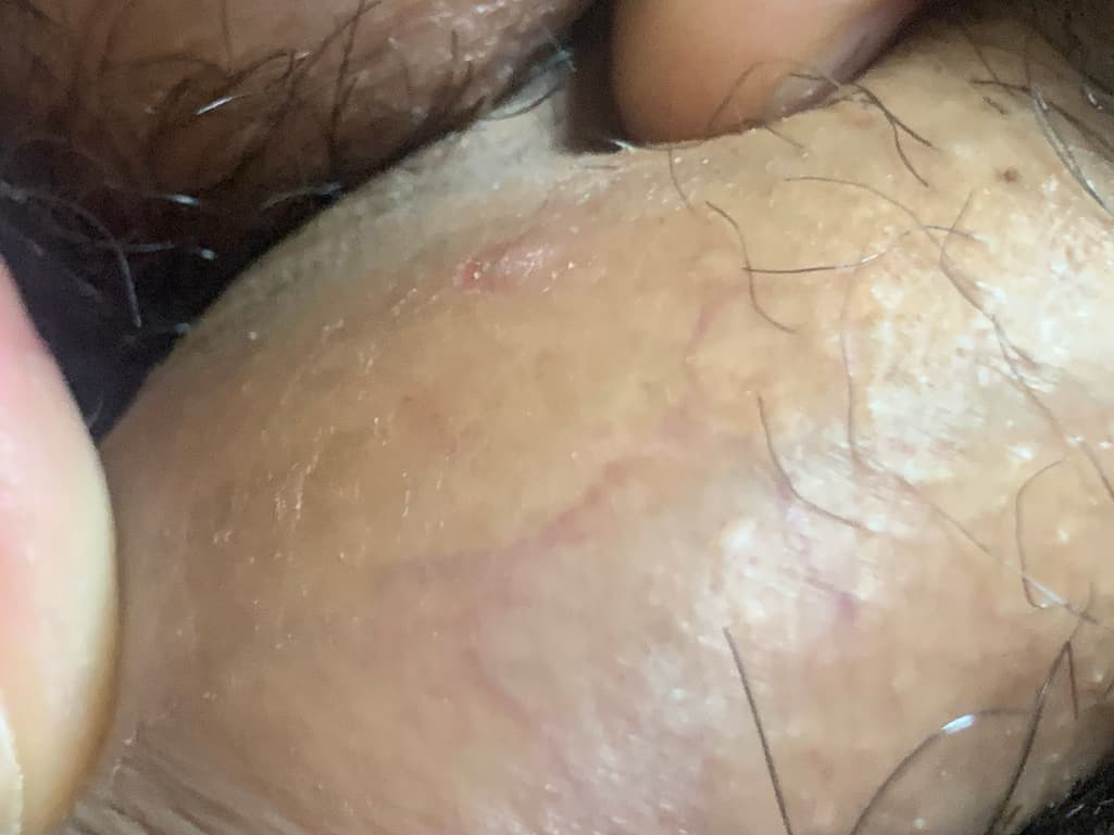 2번 째 사진