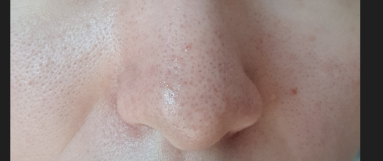 5번 째 사진