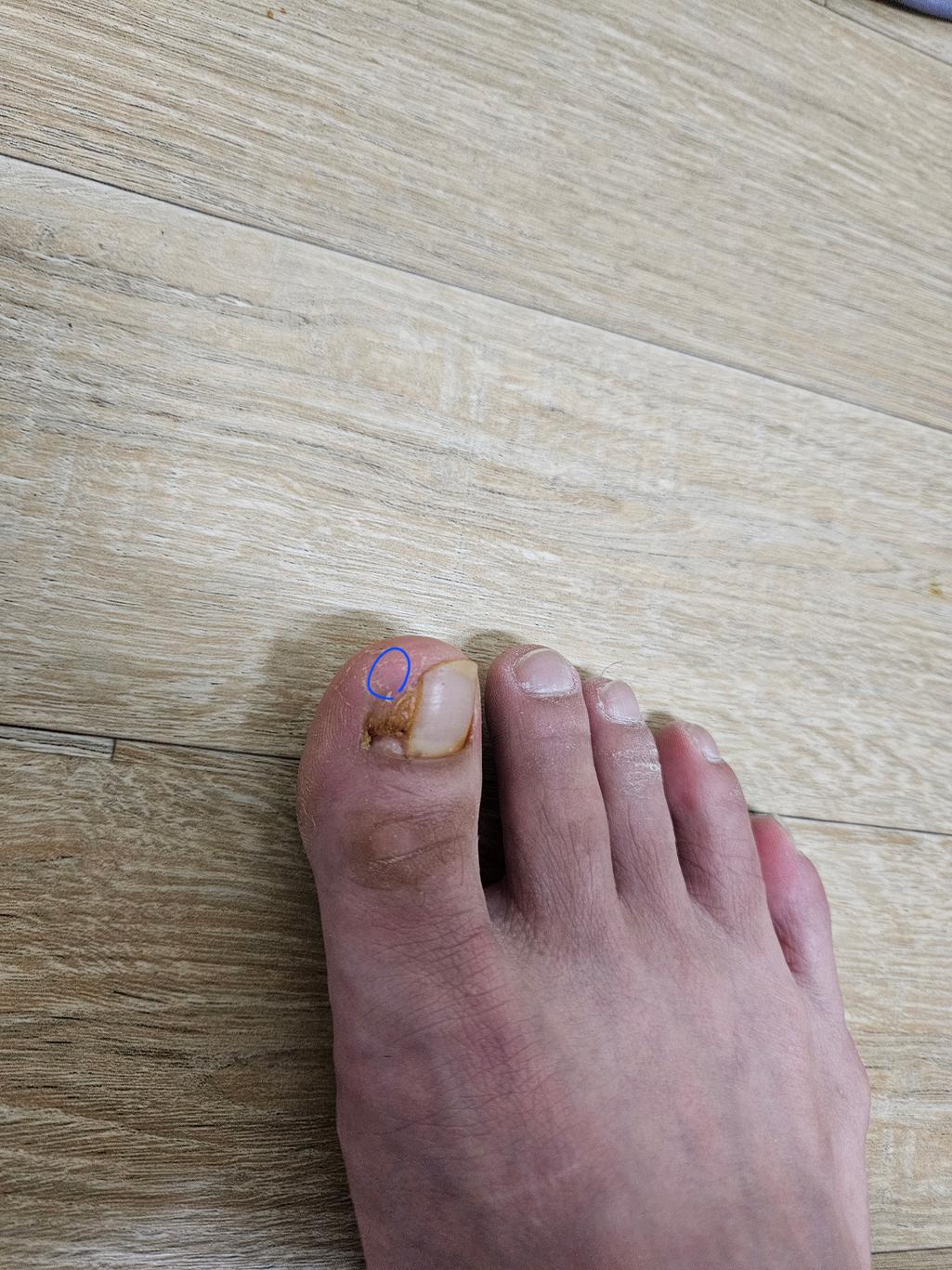 1번 째 사진