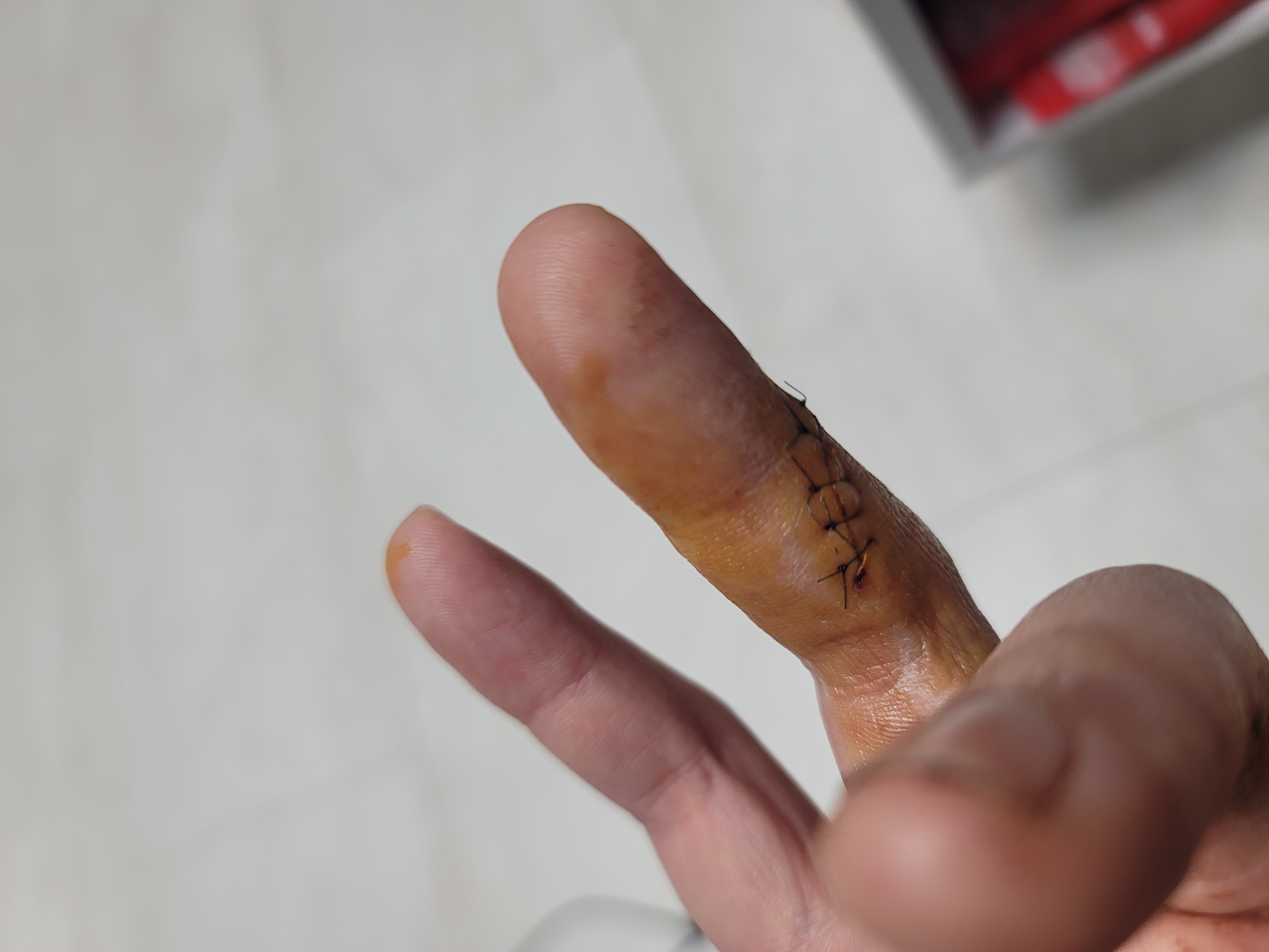 3번 째 사진