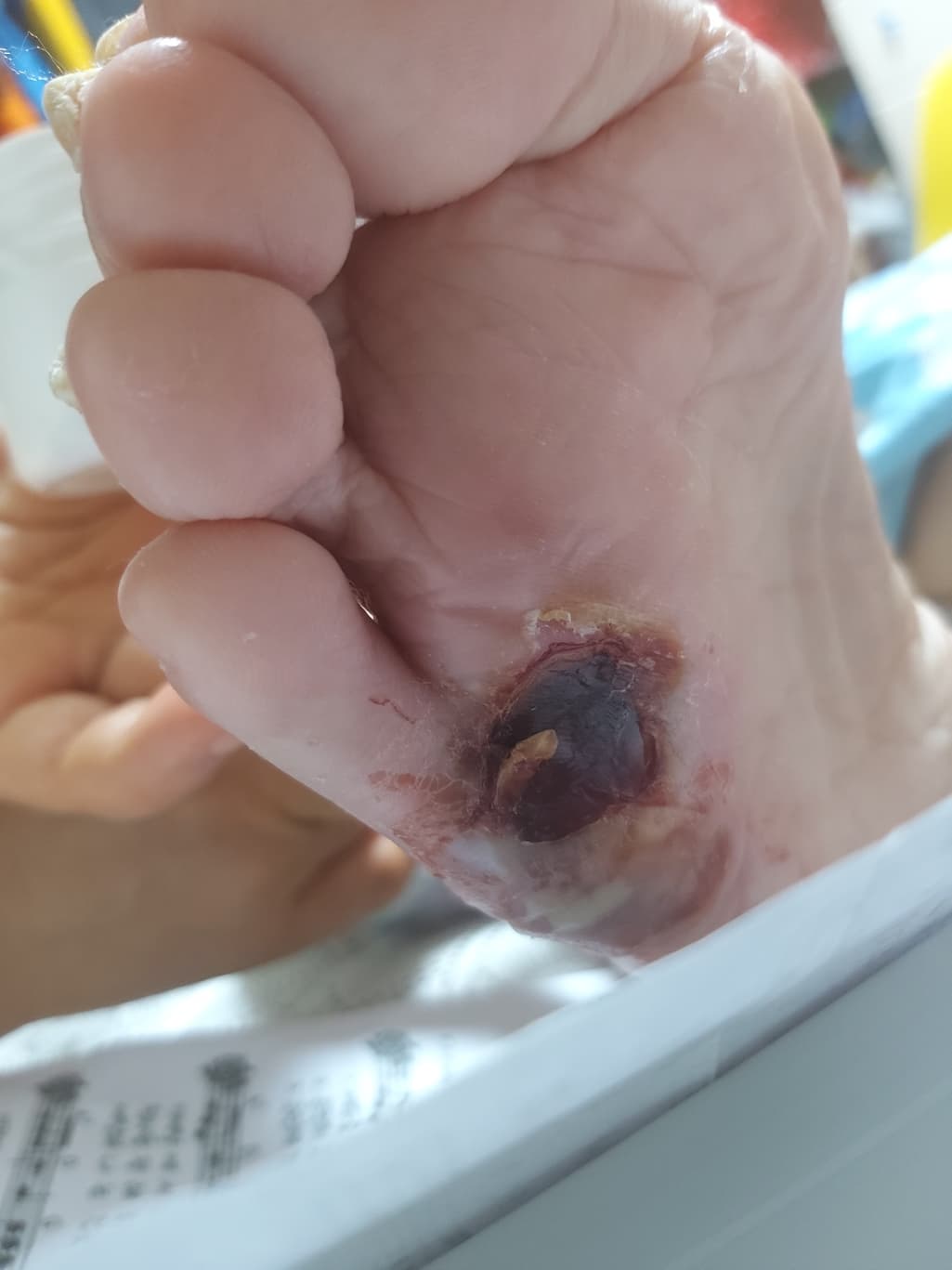 1번 째 사진