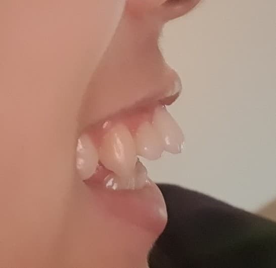 6번 째 사진