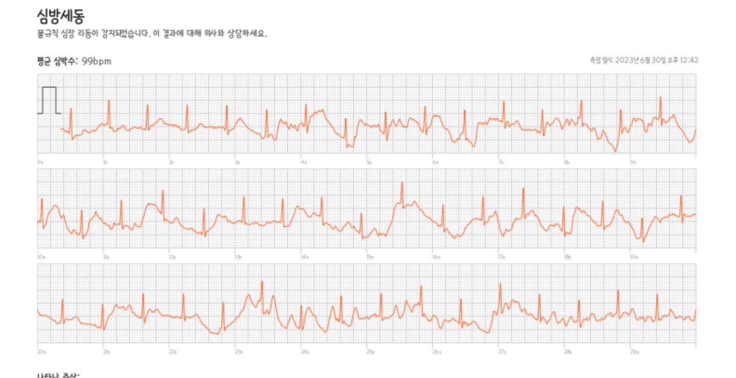 2번 째 사진