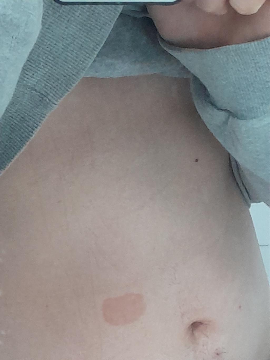 2번 째 사진