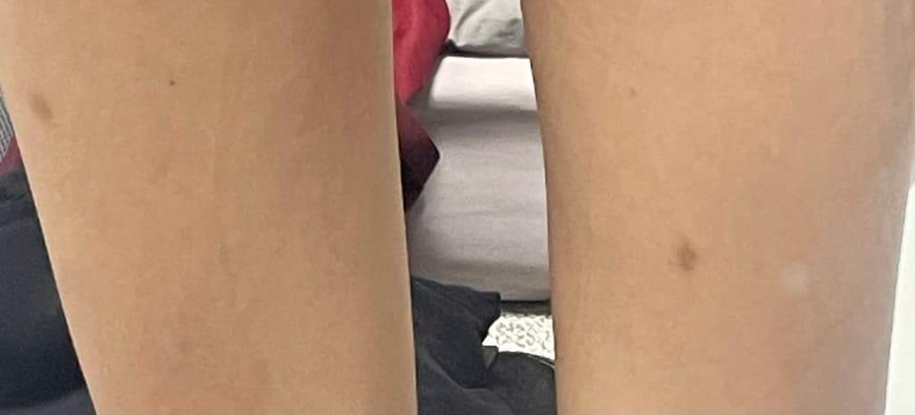 2번 째 사진