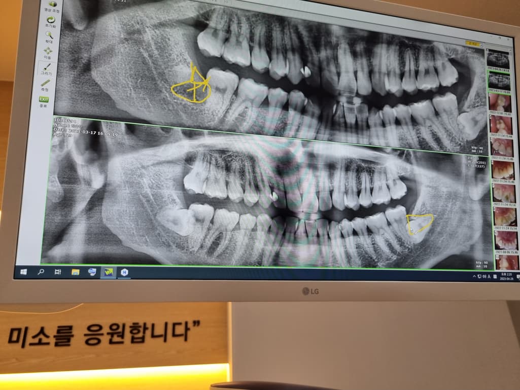1번 째 사진