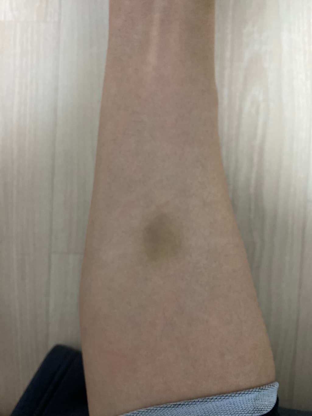 2번 째 사진