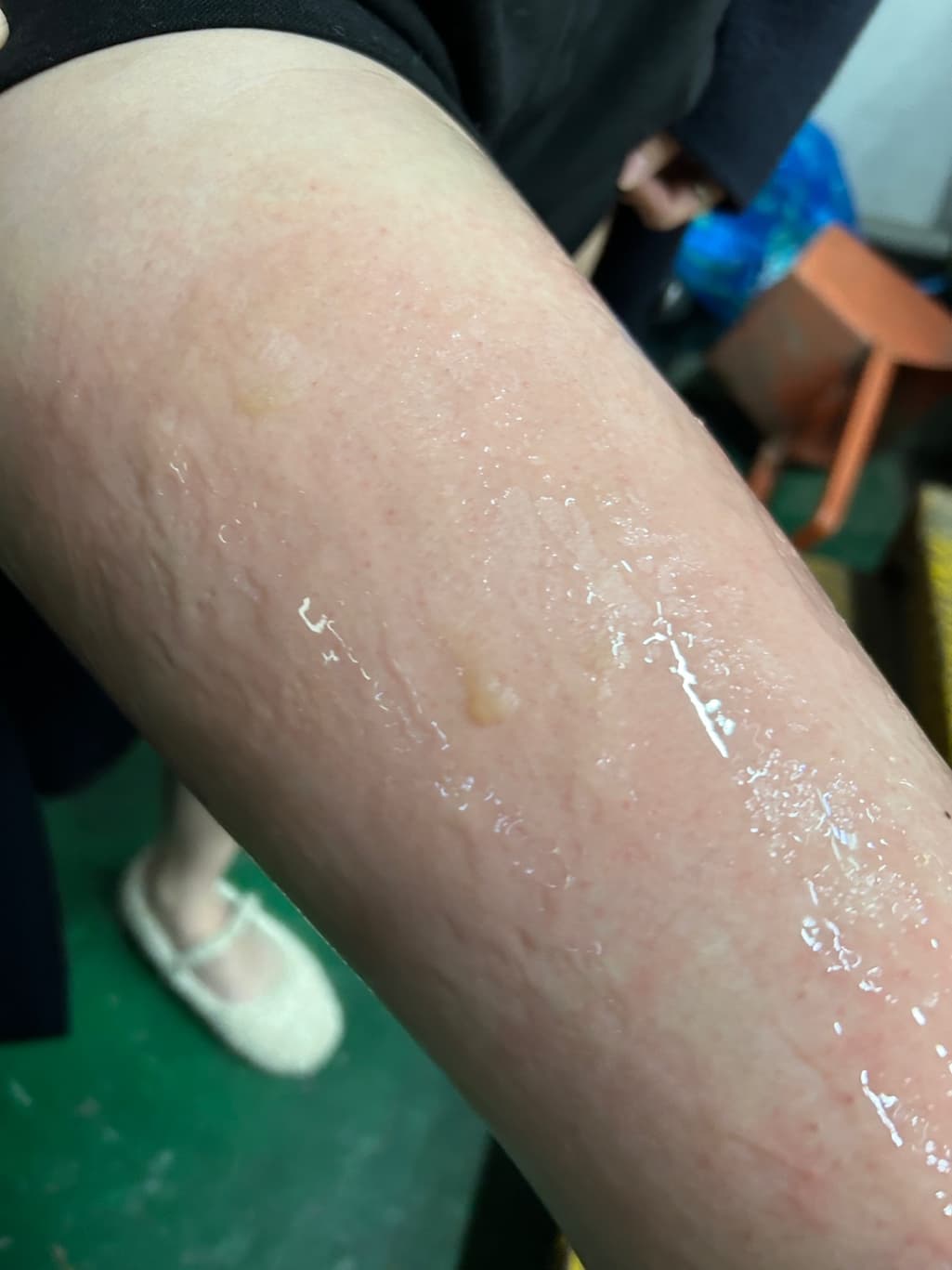1번 째 사진