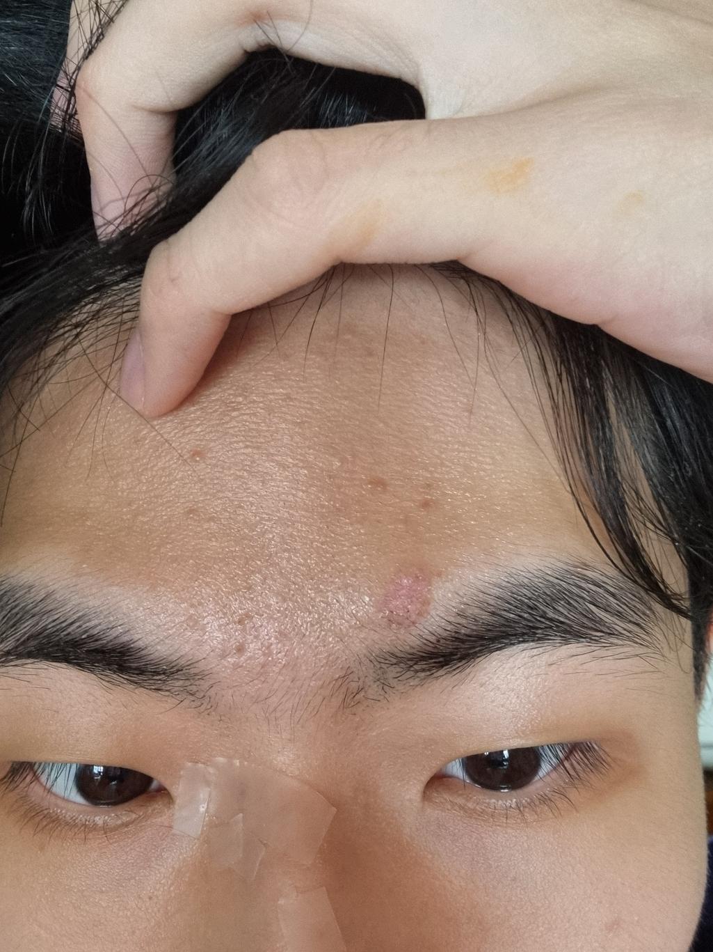 2번 째 사진