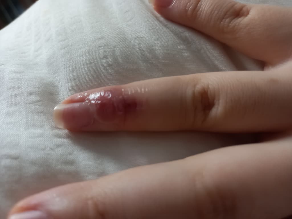 2번 째 사진