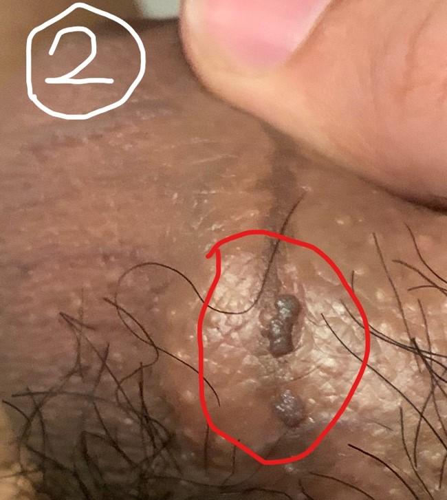 4번 째 사진