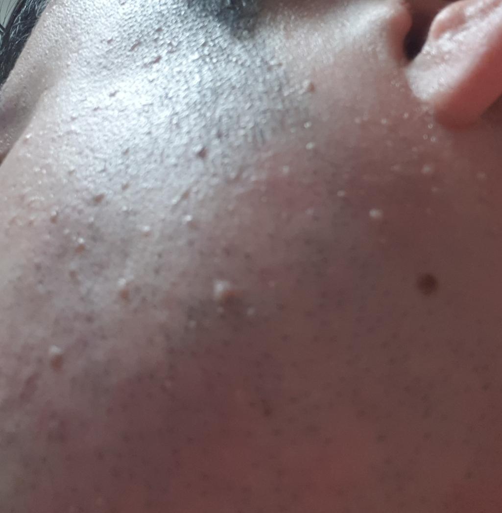 3번 째 사진