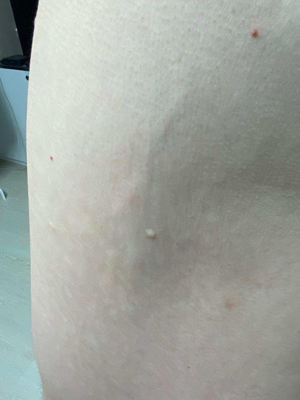 2번 째 사진