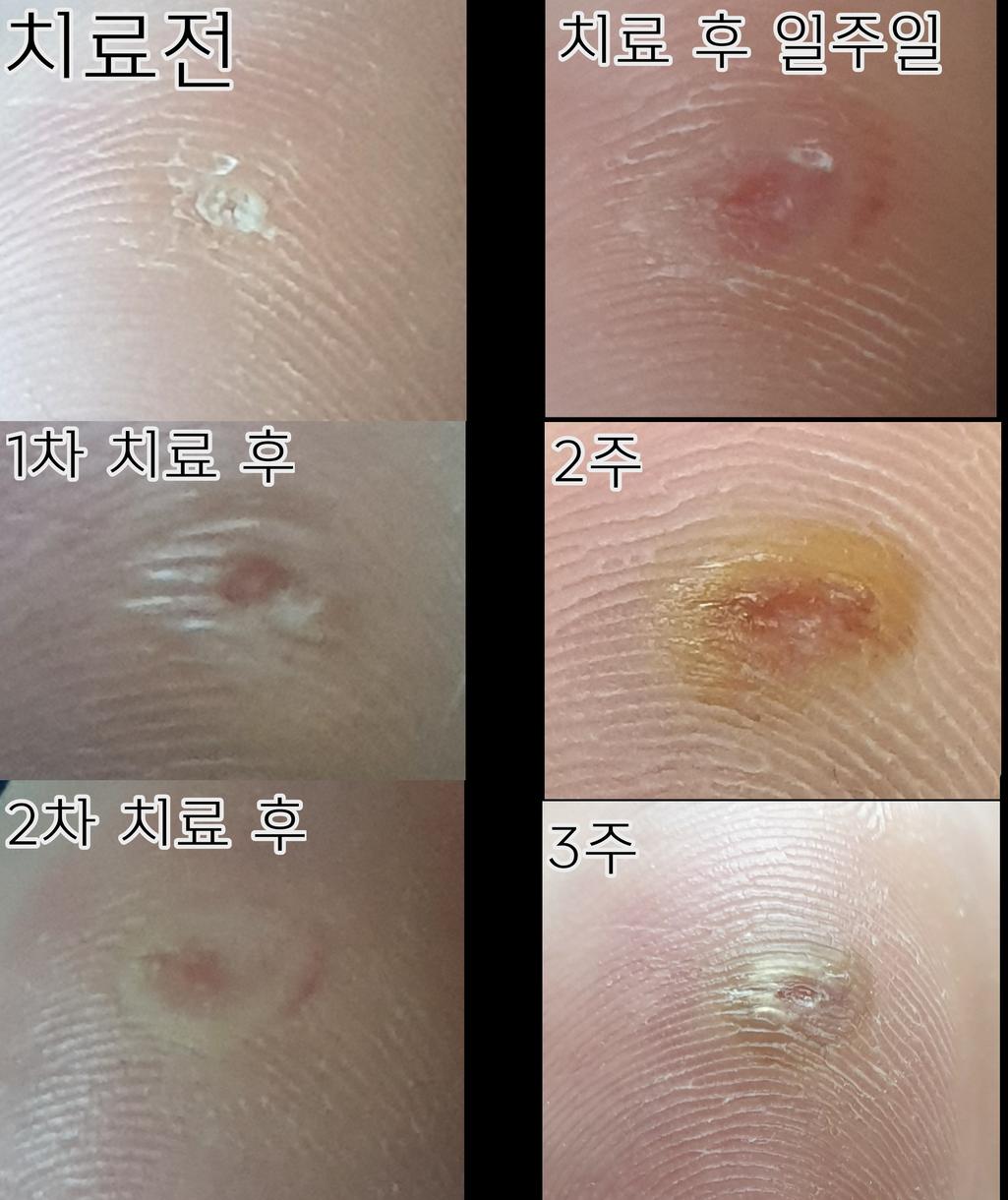 1번 째 사진