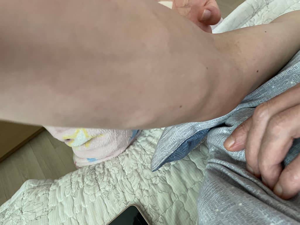 2번 째 사진