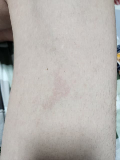2번 째 사진