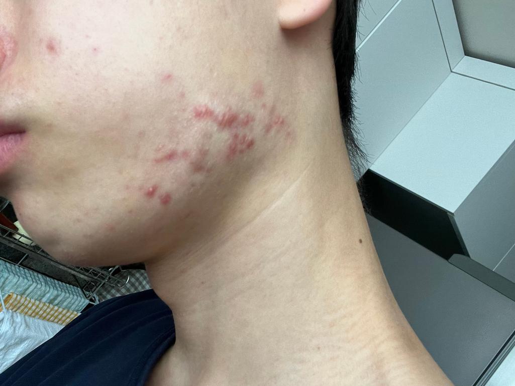2번 째 사진