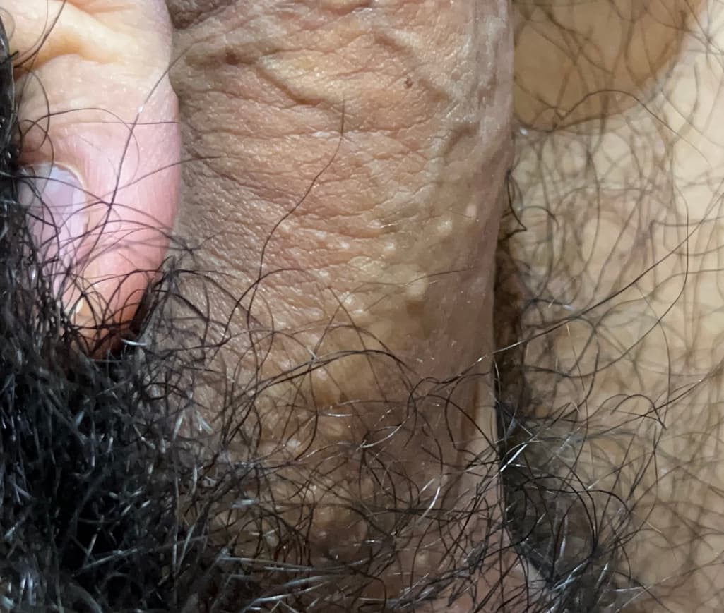 2번 째 사진
