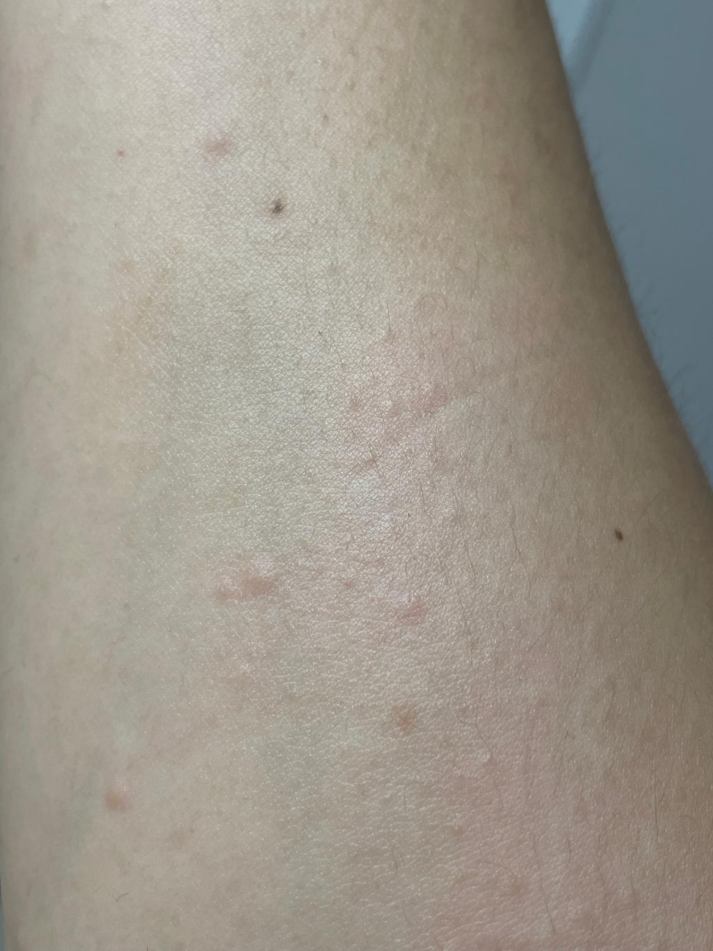 3번 째 사진