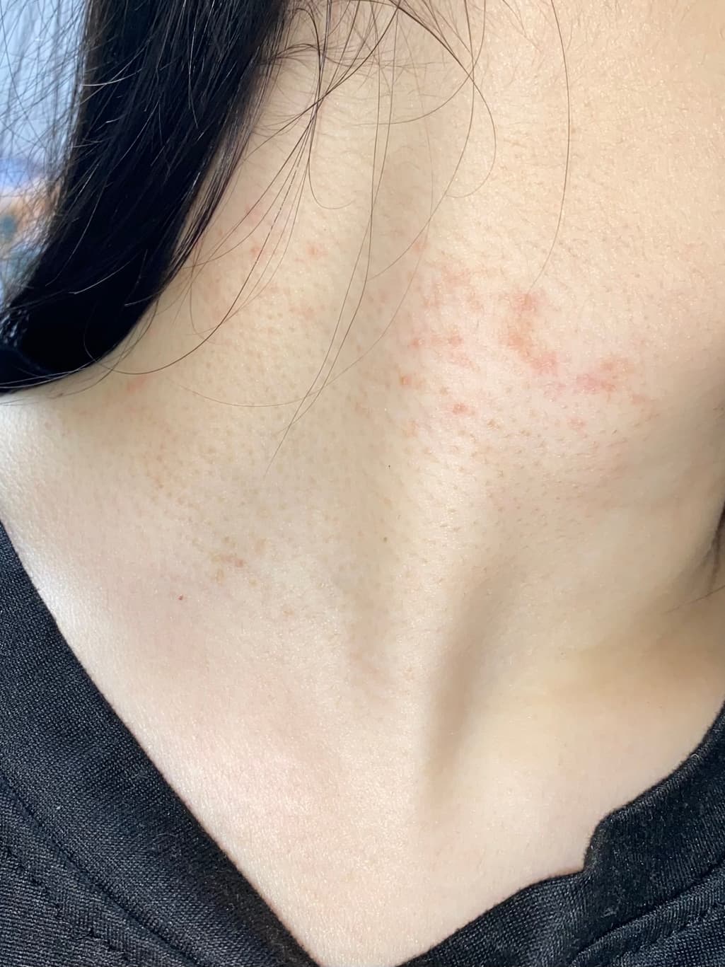 3번 째 사진