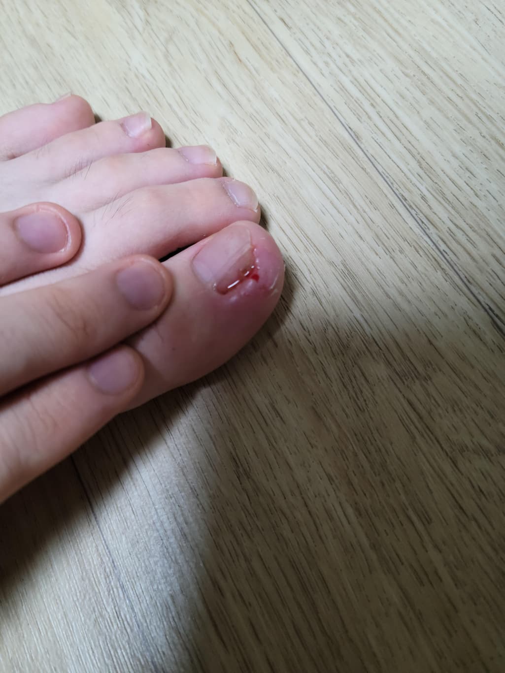1번 째 사진