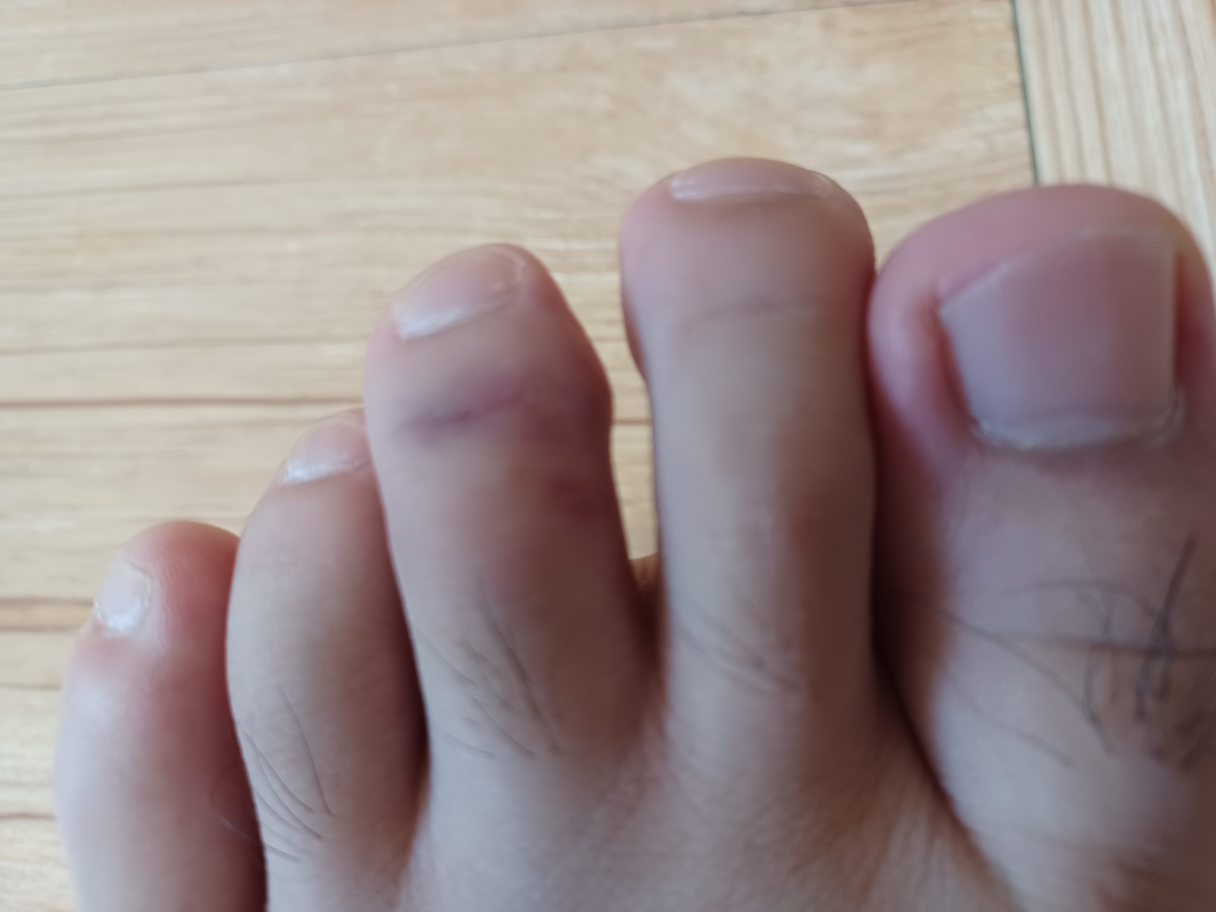 1번 째 사진