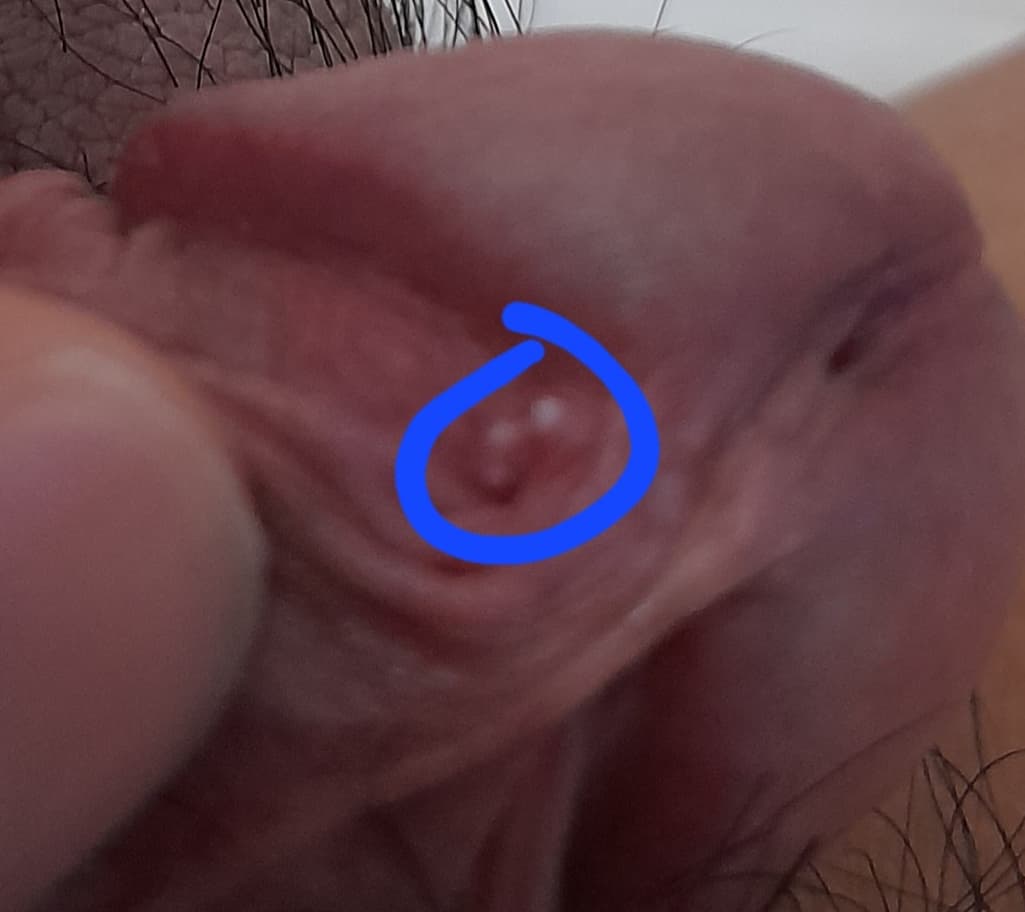 2번 째 사진