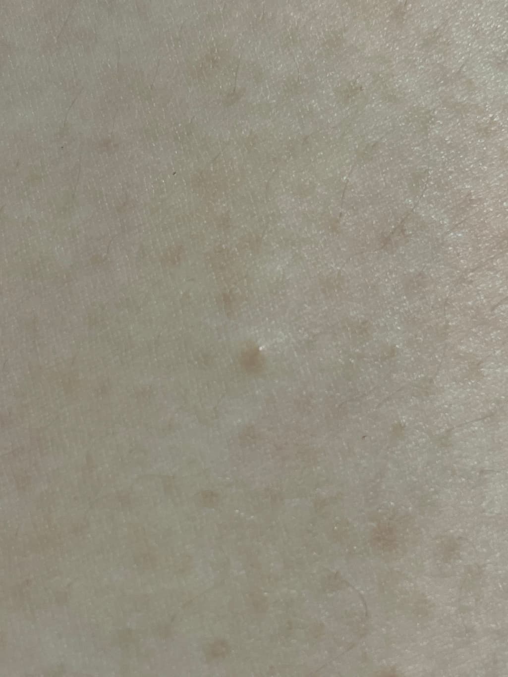 7번 째 사진