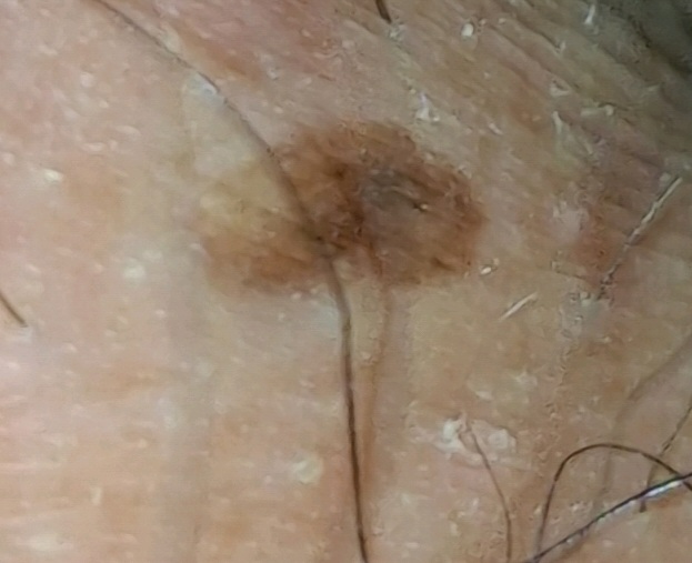 2번 째 사진