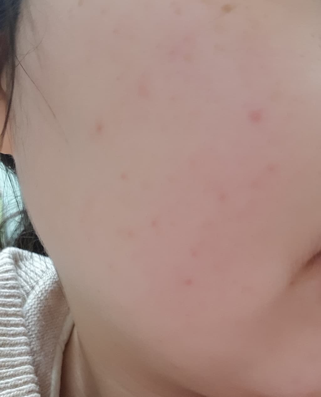 2번 째 사진
