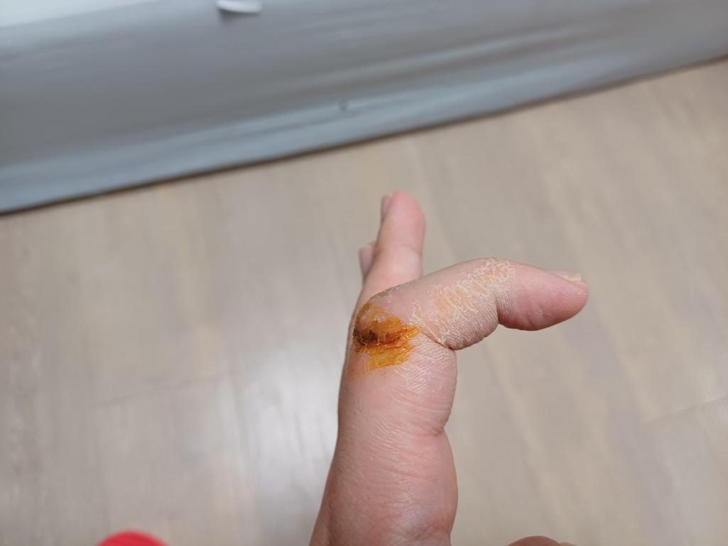 2번 째 사진