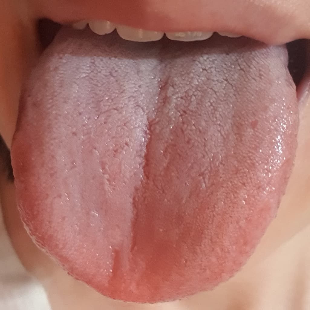 3번 째 사진