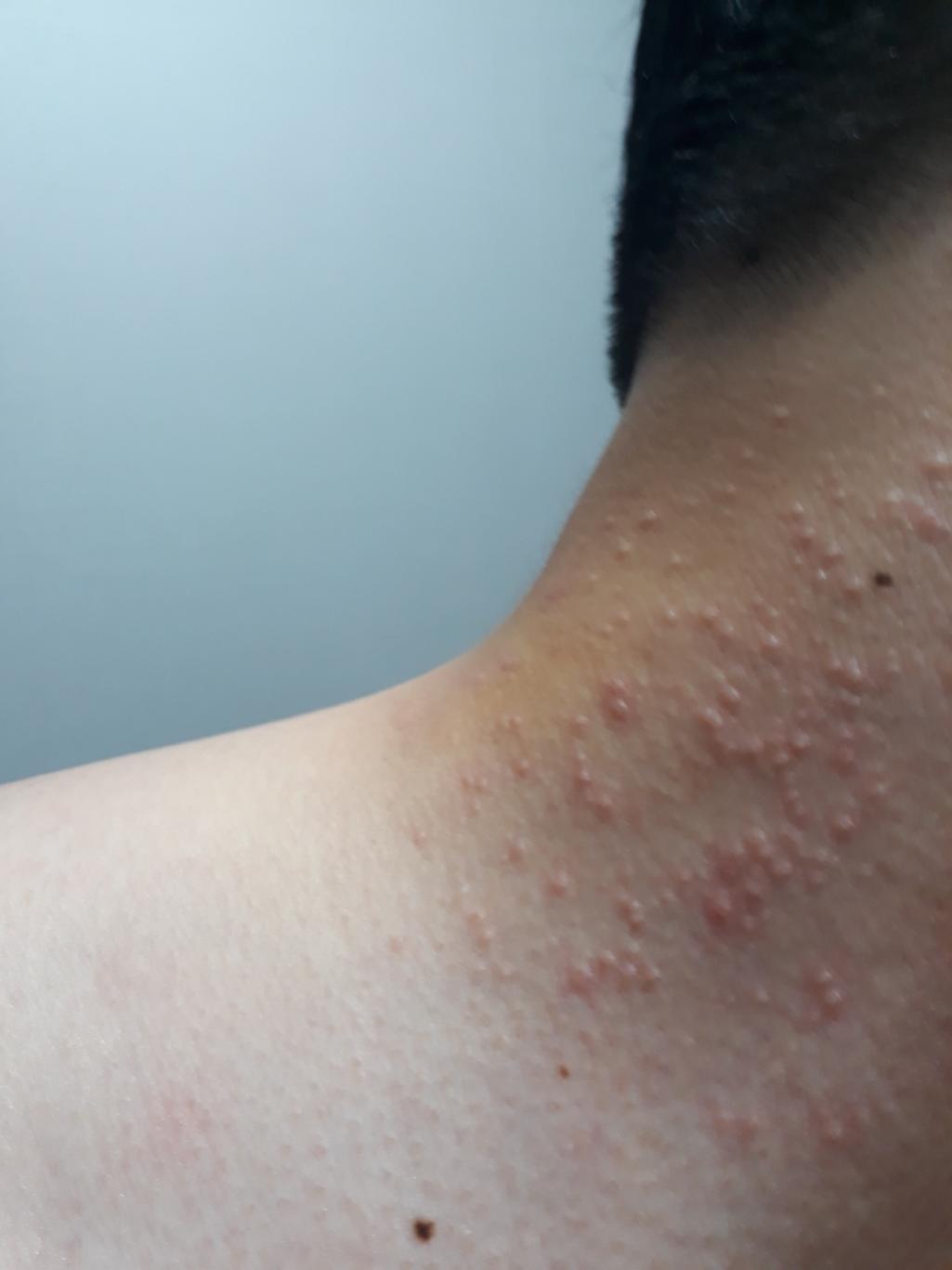 2번 째 사진
